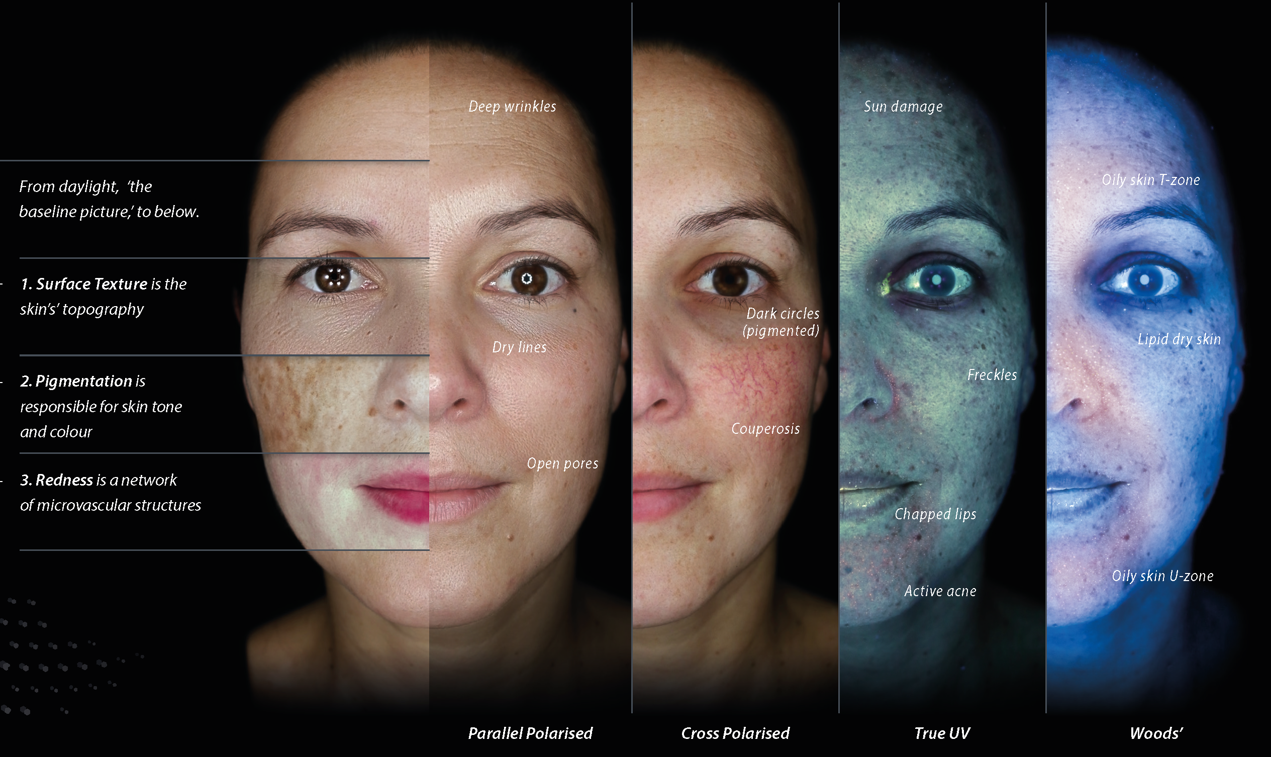 AI-Based Skin Analysis: How Technology Is Making Skin Treatments More Accurate